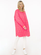 Neonpink